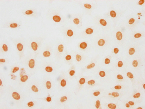 Phospho-Histone H1.5 (Ser188) Antibody in Immunocytochemistry (ICC/IF)