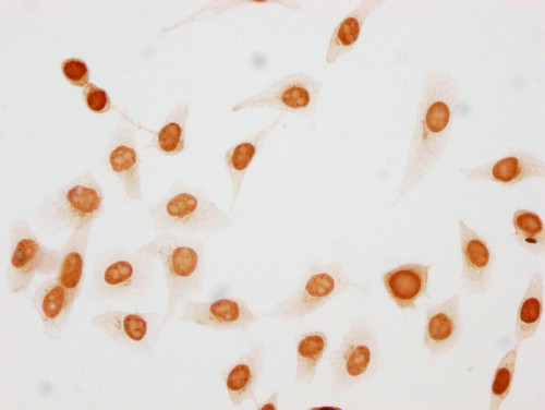 Phospho-Histone H1.5 (Thr10) Antibody in Immunocytochemistry (ICC/IF)
