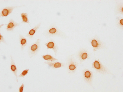 Phospho-Histone H1.5 (Thr137) Antibody in Immunocytochemistry (ICC/IF)