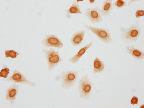 Phospho-Histone H1.3 (Thr146) Antibody in Immunocytochemistry (ICC/IF)