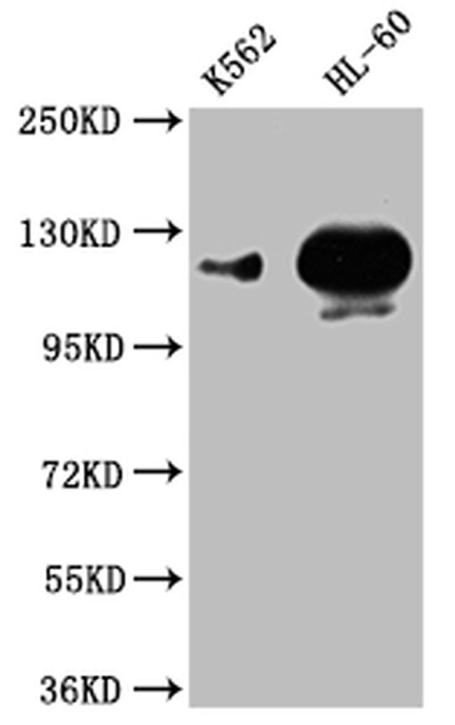 POTEE Antibody in Western Blot (WB)