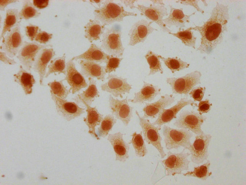 Succinyl-HIST1H2AG (Lys95) Antibody in Immunocytochemistry (ICC/IF)