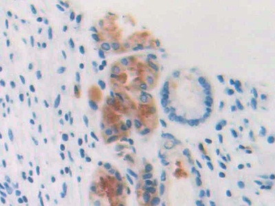 Profilin 3 Antibody in Immunohistochemistry (Paraffin) (IHC (P))