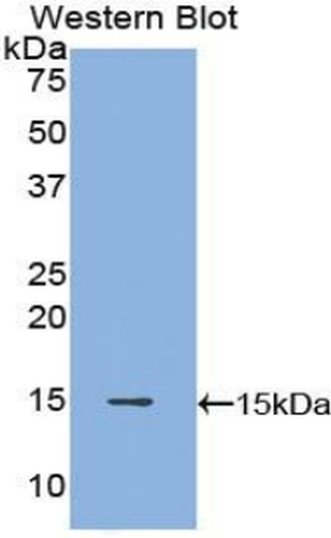 POTEJ Antibody in Western Blot (WB)