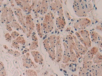 MYH16 Antibody in Immunohistochemistry (Paraffin) (IHC (P))
