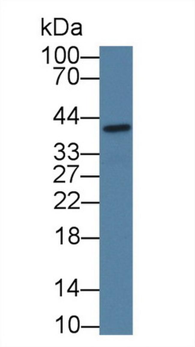 CTRB2 Antibody in Western Blot (WB)