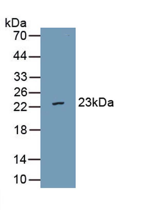 VWA5B2 Antibody in Western Blot (WB)