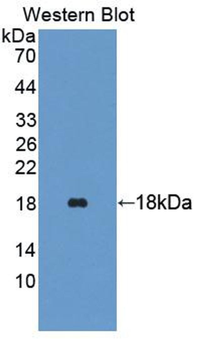 TRAPPC2 Antibody in Western Blot (WB)