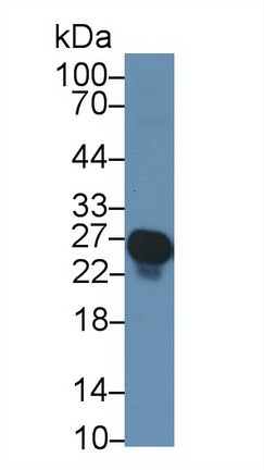 Troponin I Antibody in Western Blot (WB)