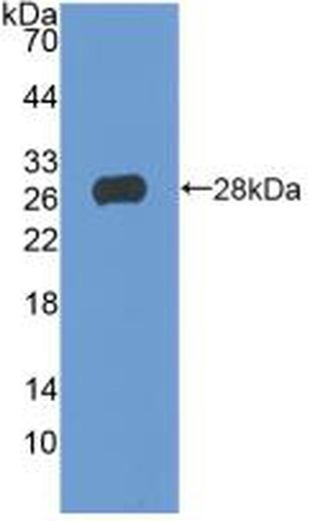 TIGIT Antibody in Western Blot (WB)