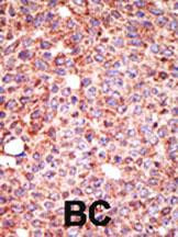 MGAT3 Antibody in Immunohistochemistry (Paraffin) (IHC (P))