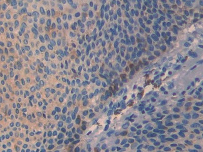 SLIT3 Antibody in Immunohistochemistry (Paraffin) (IHC (P))