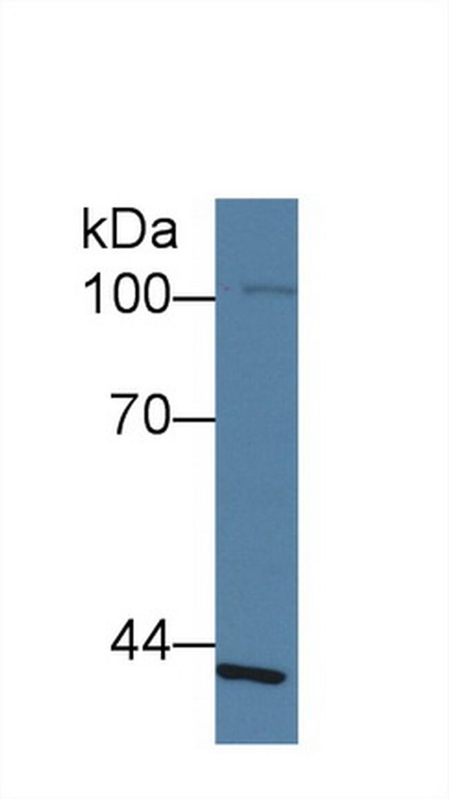 SLFN5 Antibody in Western Blot (WB)