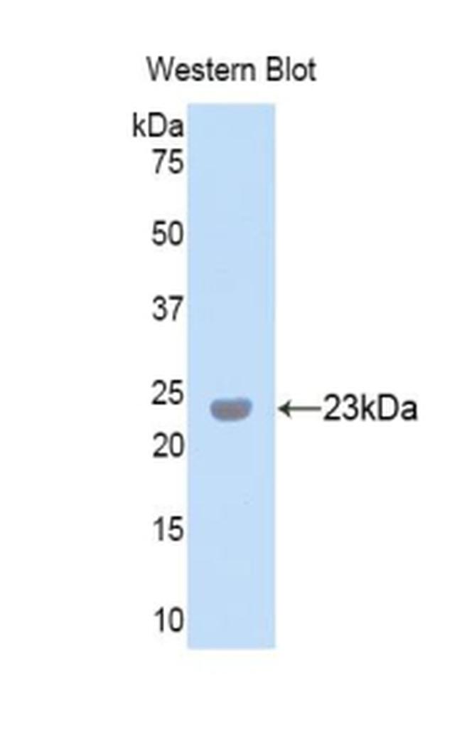 PXDN Antibody in Western Blot (WB)