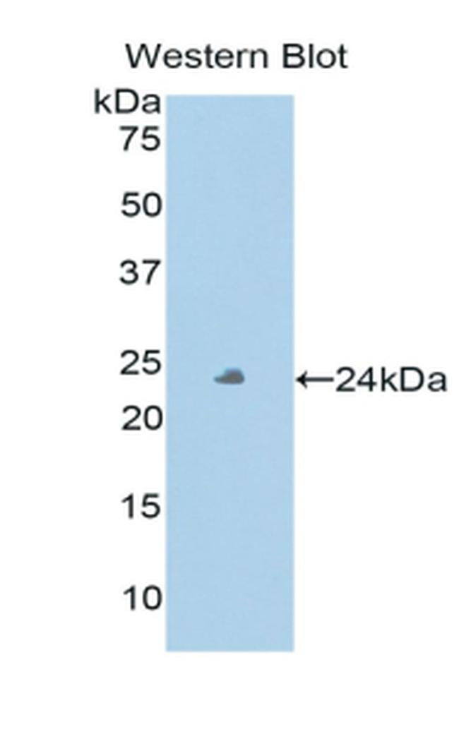 PXDN Antibody in Western Blot (WB)