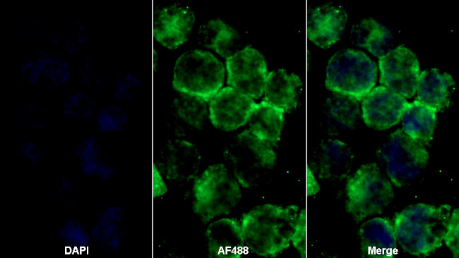 PLOD1 Antibody in Immunocytochemistry (ICC/IF)