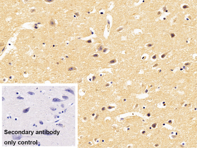PCDHB2 Antibody in Immunohistochemistry (Paraffin) (IHC (P))