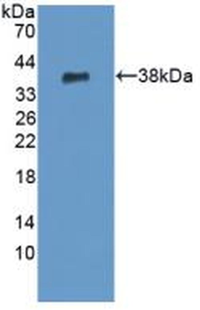 PADI6 Antibody in Western Blot (WB)