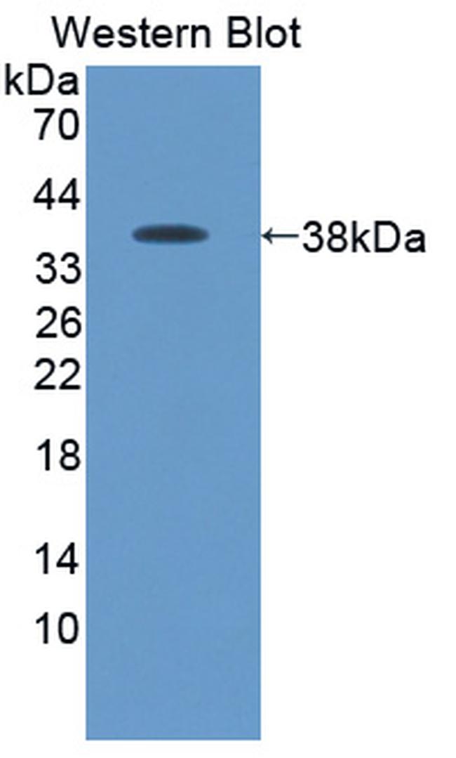 PADI3 Antibody in Western Blot (WB)