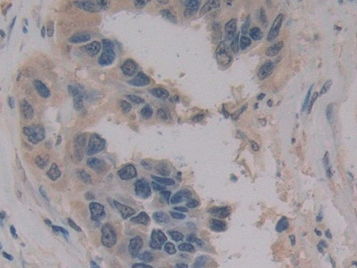 MPEG1 Antibody in Immunohistochemistry (Paraffin) (IHC (P))
