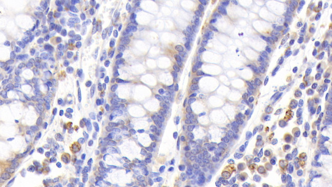 MT1 Antibody in Immunohistochemistry (Paraffin) (IHC (P))