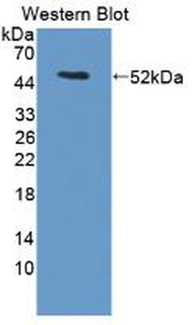 LACRT Antibody in Western Blot (WB)