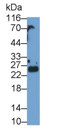SHISA4 Antibody in Western Blot (WB)