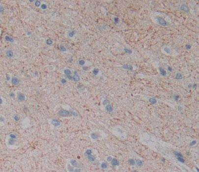 DLG5 Antibody in Immunohistochemistry (Paraffin) (IHC (P))