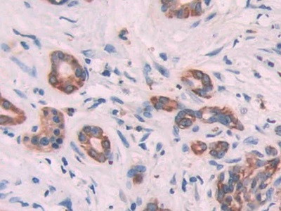Cytokeratin 6C Antibody in Immunohistochemistry (Paraffin) (IHC (P))
