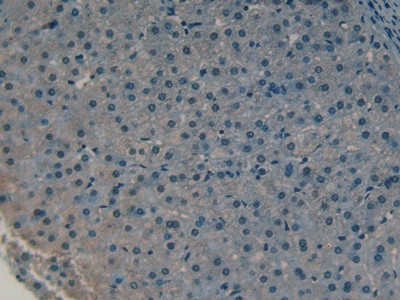 COLEC10 Antibody in Immunohistochemistry (Paraffin) (IHC (P))