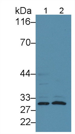 CD16 Antibody in Western Blot (WB)