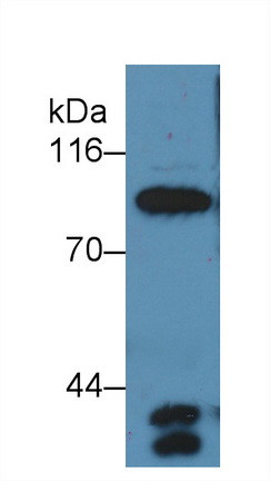 Complement C4a Antibody in Western Blot (WB)
