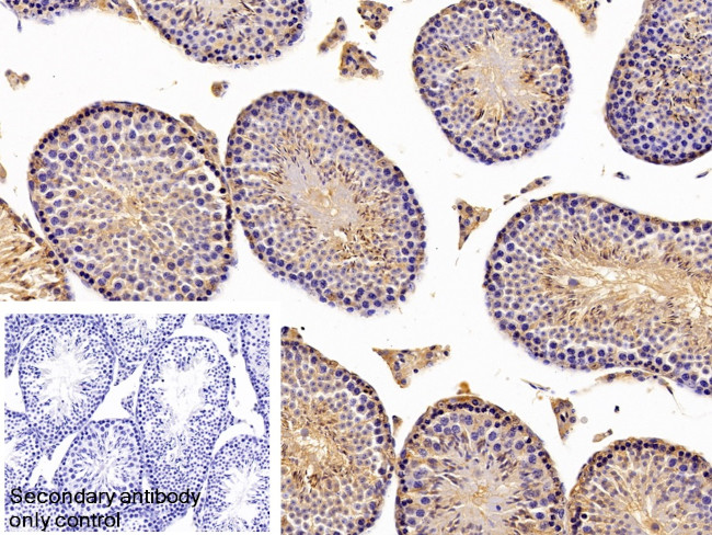 BCMO1 Antibody in Immunohistochemistry (Paraffin) (IHC (P))