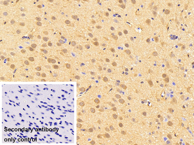 ATP7B Antibody in Immunohistochemistry (Paraffin) (IHC (P))