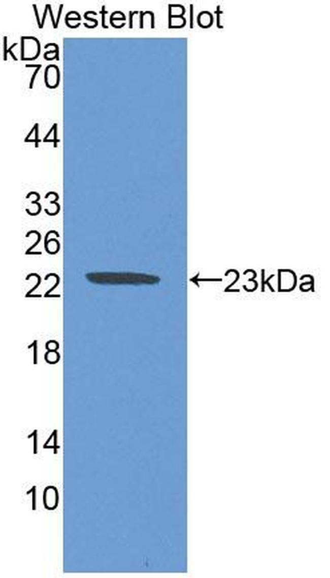ASAM Antibody in Western Blot (WB)