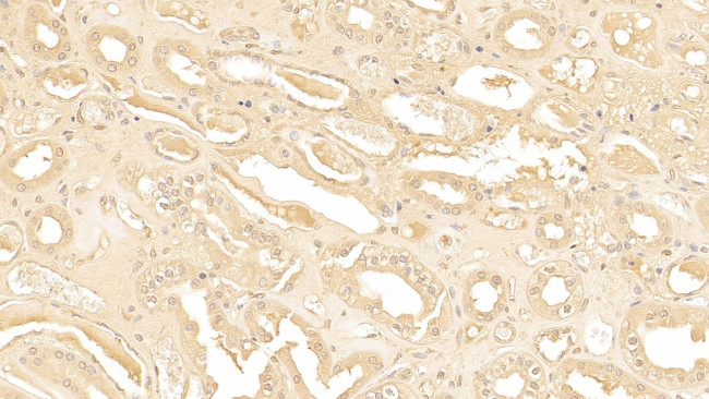 SERPINA3 Antibody in Immunohistochemistry (Paraffin) (IHC (P))