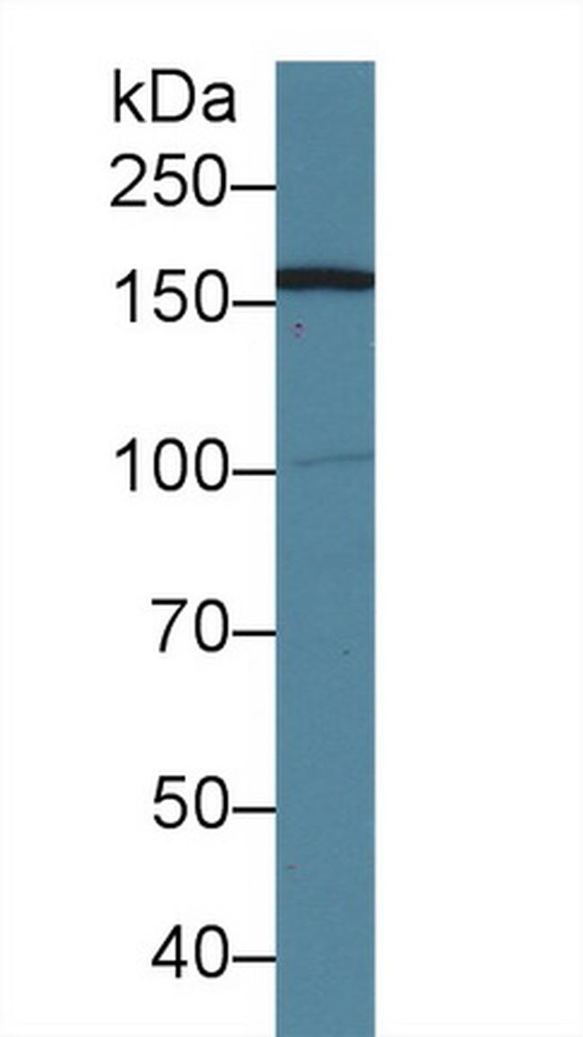 AIM1 Antibody in Western Blot (WB)
