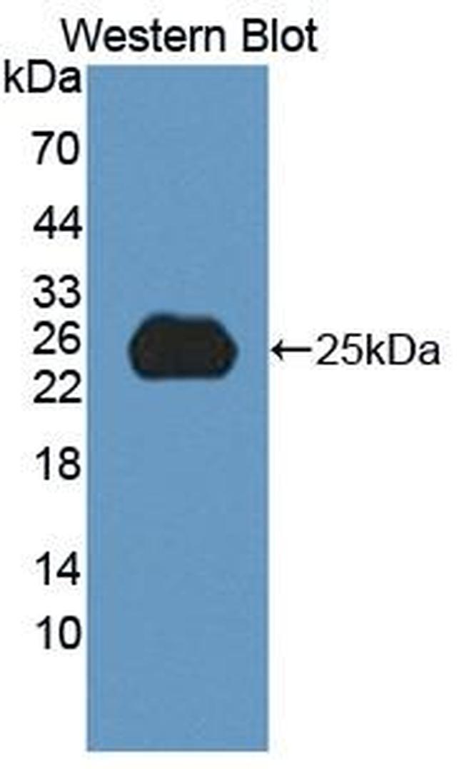 SPP24 Antibody in Western Blot (WB)