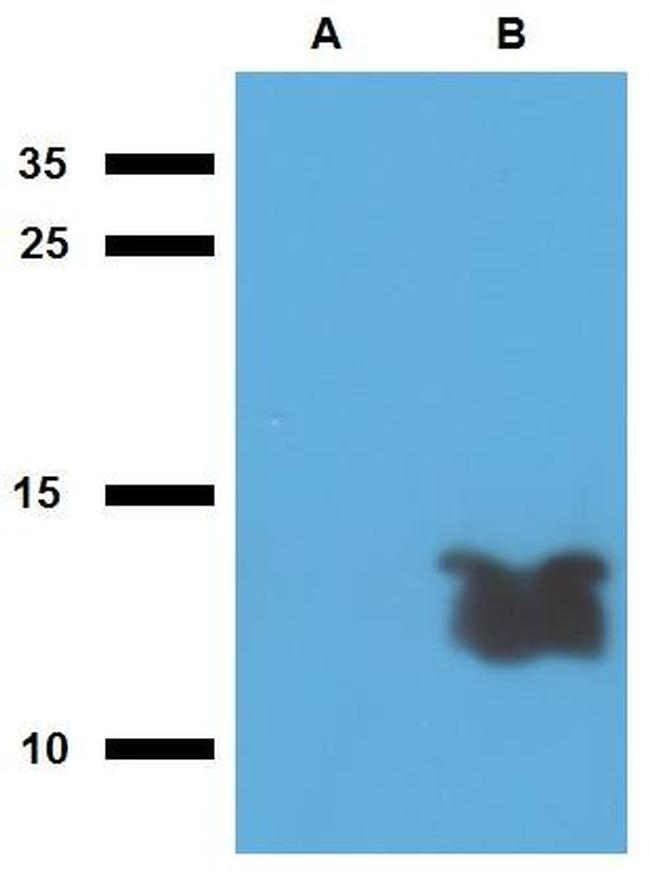 Mycobacterium tuberculosis Tb7.7 Antibody in Western Blot (WB)