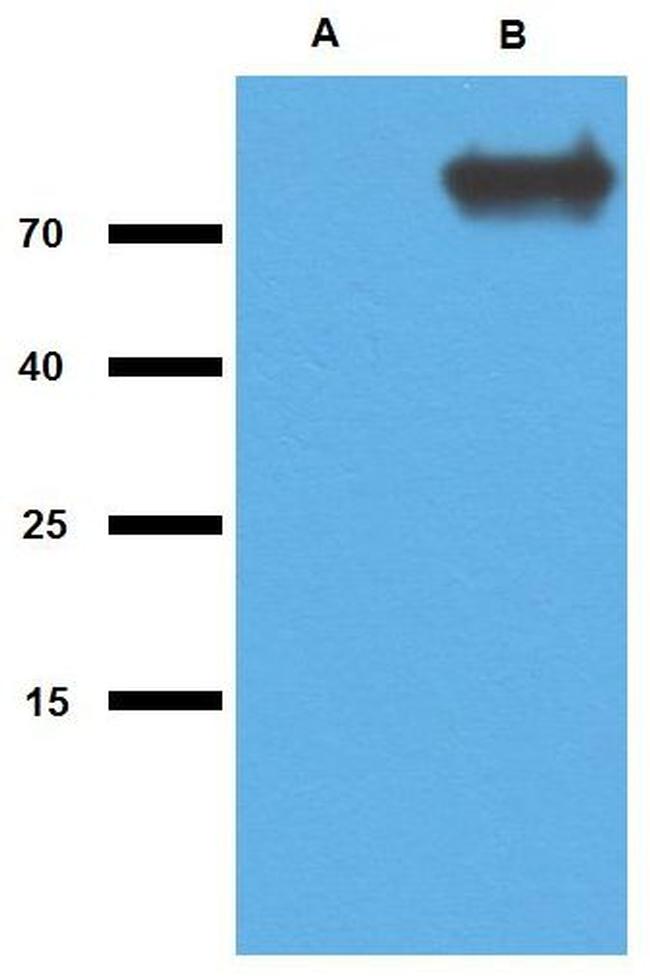 Mycobacterium tuberculosis GlcB Antibody in Western Blot (WB)