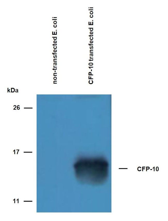 Mycobacterium tuberculosis CFP-10 Antibody in Western Blot (WB)