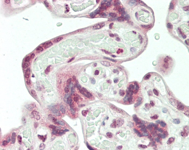 HERV Antibody in Immunohistochemistry (Paraffin) (IHC (P))