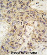 ANGEL2 Antibody in Immunohistochemistry (Paraffin) (IHC (P))