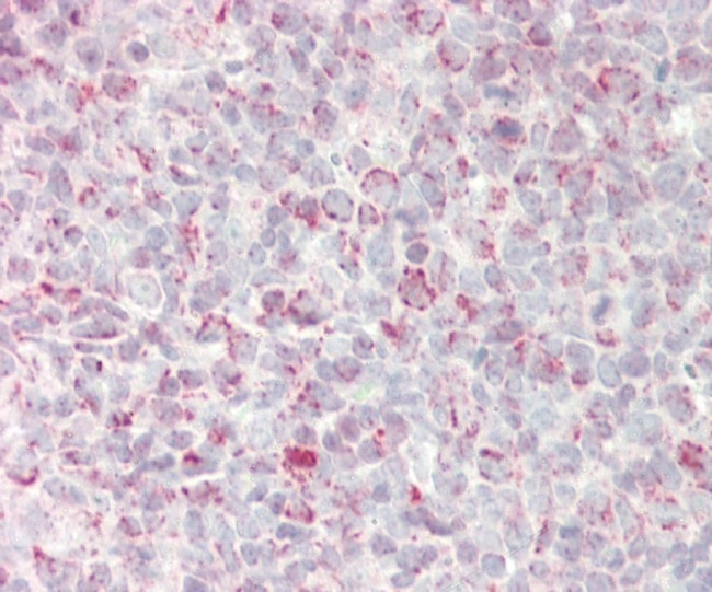 GADD45A Antibody in Immunohistochemistry (Paraffin) (IHC (P))
