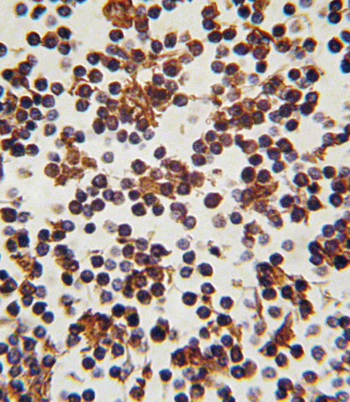 FOXP3 Antibody in Immunohistochemistry (Paraffin) (IHC (P))