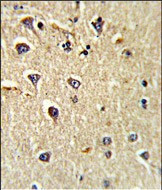 CD166 Antibody in Immunohistochemistry (Paraffin) (IHC (P))