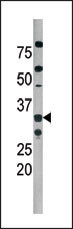 Phospho-CDK2 (Thr160) Antibody in Western Blot (WB)