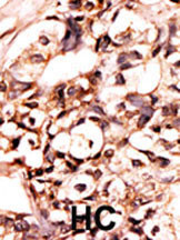 Phospho-DAXX (Ser213) Antibody in Immunohistochemistry (Paraffin) (IHC (P))