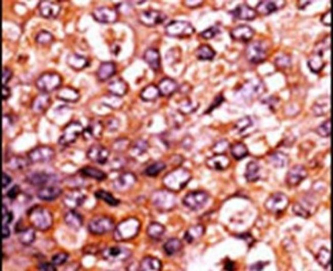 Phospho-FGFR (Tyr653, Tyr654) Antibody in Immunohistochemistry (Paraffin) (IHC (P))