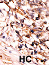 Phospho-PRAK (Ser93) Antibody in Immunohistochemistry (Paraffin) (IHC (P))